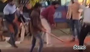 images 15 - दाल में कंकड़ मिलने पर बहस ढाबा मालिक ने युवक को पीटा, मारपीट का मुकदमा दर्ज।