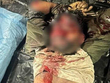 88 17 1766211934 - मया बाजार–टडौली रेलवे ट्रैक पर कटा हुआ अज्ञात शव मिलने से हड़कंप।